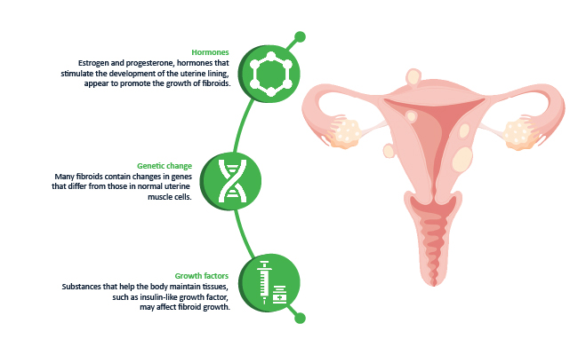 causes of uterine fibroids