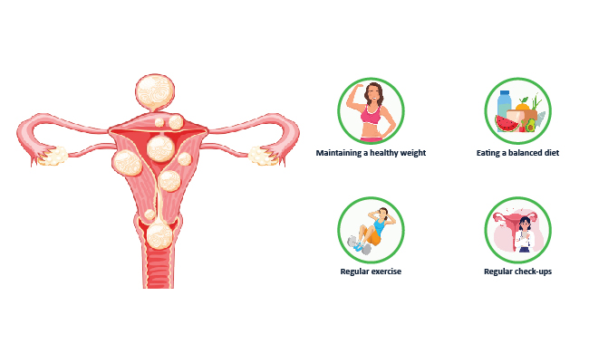 How-to-prevent-uterine-fibroids