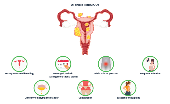 symptoms of uterine fibroid