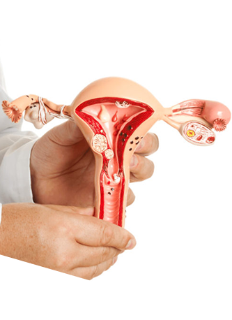 women uterus image